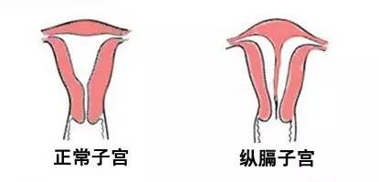 房間裝修設(shè)計圖_房間裝修效果圖_寶寶房間裝修